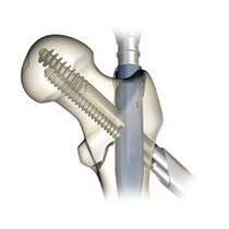 Smith & Nephew Trauma & Extremities